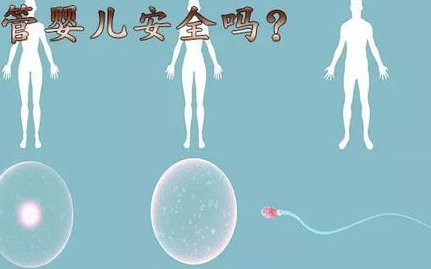 《拉萨哪家医院？》拉萨哪家医院可以做三代试管婴儿