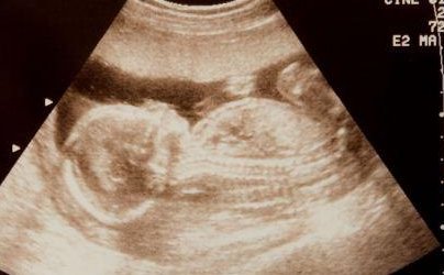 2026国内第三代试管婴儿医院排名哪家医院较好？