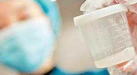 想要提高试管的成功率避免这四个行为，想要提高试管婴儿的成功率这几个细节不要忽视！