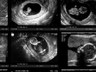 南京地区有哪些私立的机构可以做试管技术？南京鼓楼医院生殖科专家汇总